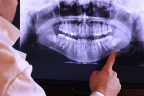 Best Holiday Emergency Dentist in Burlington, VT